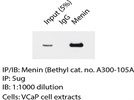 Menin Antibody for Western Blotting
