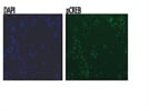 pCREB expression in N2A cells