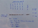 Anti-Galpha 11 Antibody for Western blot and Immunoprecipitation