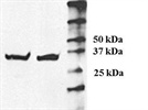Detection of NCR1 in NK cells