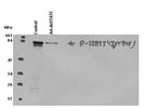 Excellent Antibody for pSTAT3 (Tyr705)