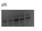 pERK Expression in Neuronal Cells (N2A)