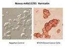 Immunocytochemistry of a Her2 Variant