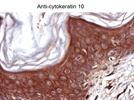 Review for Anti-Cytokeratin 10 Antibody