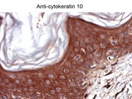 Review for Anti-Cytokeratin 10 Antibody