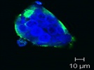 Detection of PGP in Colon Cancer Cells