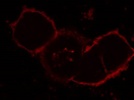 Detection of EpCAM in Cancer Cells