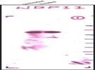 WBP11 Antibody