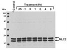 Myosin Light Chain 2 Antibody from Cell Signaling Technology Gives Good Results