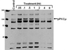 Bad Detection of Phospho-PKD/PKCµ (Ser744/748)