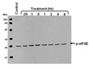 Excellent Phospho-eIF4E (Ser209) Antibody for Immunoblotting