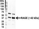 RAGE Antibody With Minimum Nonspecific Bands for Mouse and Human Samples