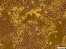 C Tubes & GentleMACS Dissociator for Tumor Dissociation