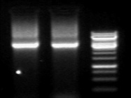 Excellent DNA Polymerase for PCR Amplification of Larger Fragments