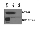 Western Blot Analysis of Na+/K+-ATPase Alpha 1