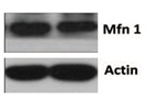 Western Blot Analysis of MFN1
