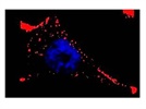 Immunocytochemistry of Caveolin1