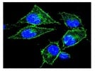 Immunocytochemistry of EGFR