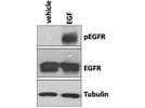 Western Blot Analysis of Phospho-EGFR (Y1173)