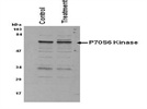 Good Antibody for p70 S6 Kinase Immunodetection