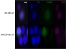 ICC/IF Staining of XBP1s-GFP-Transfected Multiple Myeloma Cell Lines with Biolegend Anti-XBP-1s 647502