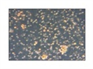 Human Peripheral Blood Mononuclear Cells