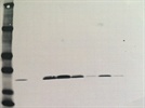 Measurement of Protein Synthesis Through Ribosmal Protein s6