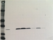 Measurement of Protein Synthesis Through Ribosmal Protein s6