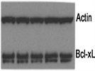 Bcl-xL Expression in Jurkat Cells
