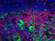Tips for Selecting Fluorescent/Enzymatic Labels for Multi-color Immunohistochemistry Experiments