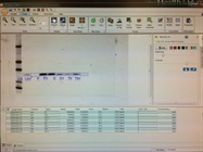 Western Blot Densitometry in LI-COR Image Studio