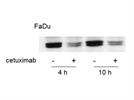 T202/Y204-phosphorylated Erk Antibody from Cell Signaling Technology