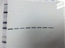 Total s6 Ribosomal Protein