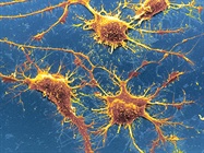 Alzheimer`s Disease - A Review
