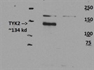 Best TYK2 Antibody