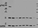Best Phospho-TYK2 Antibody on the Market