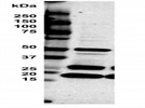Oxphos Antibody for Human