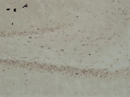 Immunohistochemistry with SC48 Antibody