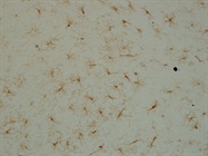 Iba1 in Rat Brain