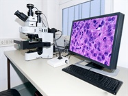 Pinpointing the Details of Confocal Microscopy