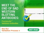 Validated Western Blotting Antibodies That Work Every Time