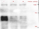 An Okay Antibody for Detecting PIAS4