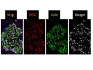 NR5A2 Staining in Human Pancreas