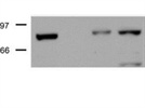 Anti-PKP3 in Western Blot
