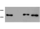 Anti-IL8 in Western Blot