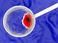 Overcoming the Challenges of Transfecting Stem Cells