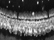 Great Antibody to Stain Cochlear and Vestibular Hair Cells
