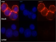 ICC/IF staining of Daudi and Jurkat cell lines with Abcam Anti-CD20 ab9475