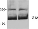 Gli2 Antibody for Western Blotting