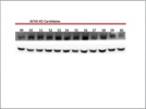Okay GCN5L2 Antibody, High Background